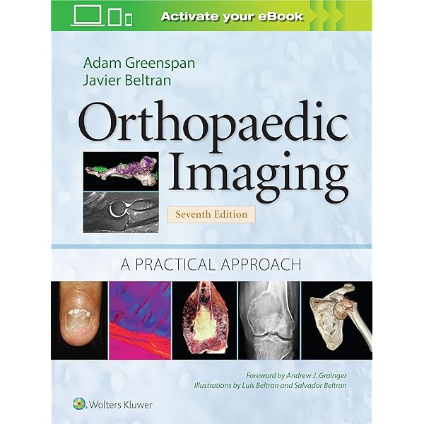 裁断済 Diagnostic Imaging: Musculoskeletal 裁断済 Diagnostic Imaging: Musculoskeletal Diagnostic